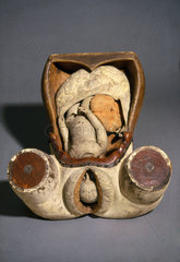 Obstetric model of the womb and genitalia  18th century.