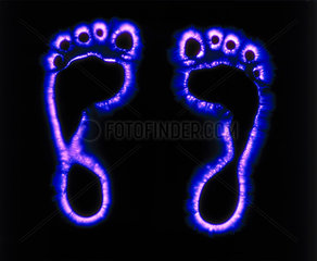 Kirlian photograph of a child’s feet.