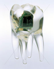 Audio tooth implant  2002.