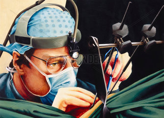 Mr Stephen Westaby  cardiothoracic surgeon  1991.