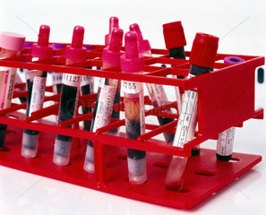 Blood samples thawing prior to DNA preparation.