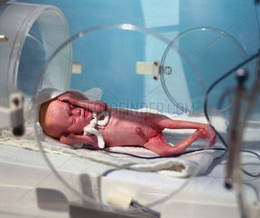 Premature baby  1998.