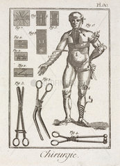 Bandaging a human figure  1780.