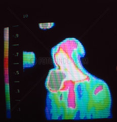 Thermal image of a person drinking  c 1980s.