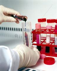 Scientist pouring a blood sample in preparation for DNA analysis.