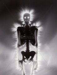 Kirlian photograph of a skeleton.