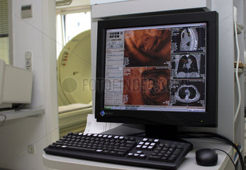 Computer Tomographie