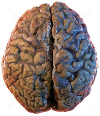 menschliches Gehirn