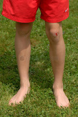 Junge in roten Sporthosen mit aufgeschlagenem Knie auf Wiese.