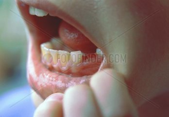 Kind haelt ausgefallenem Zahn