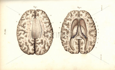 Cross sections through the brain