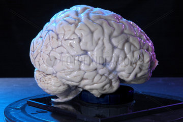 menschliches Gehirn