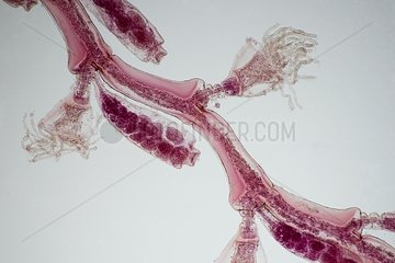 Hydroids of Jellyfish microscope