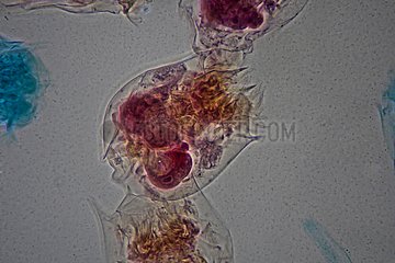 Microscopic view of Rotifers