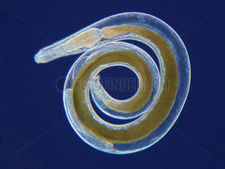 Anguillicola (Anguilicoloides crassous) Parasitic nematodes of the swimming bladder of eels. This parasite was introduced accidentally into Europe in the 1980s from eels imported from Japan. Note that small individuals are little colored while adults are filled with the blood of the eel where they were found; The tallest individuals measure about one centimeter.