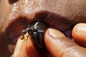 The Honey Ants Dream. A honeypot ant in the mouth of an Aborigine child regurgitates a drop of honeydew. Northern Territory  Australia