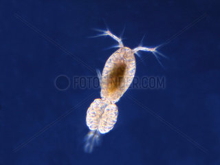 Plankton: This female ovigerous copepod carries its eggs on its caudal appendix. Length 1.1 mm