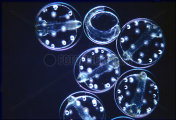 Fish eggs as found in sea water  ie as marine plankton. The oil bubbles that are the nutrient reserves of the larvae are seen for the following days.