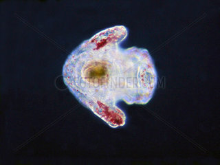 Very young planktonic larva of Sea Urchin (Sphaerechinus granularis). Size about 0.6 mm
