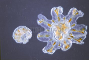 Young jellyfish 1mm