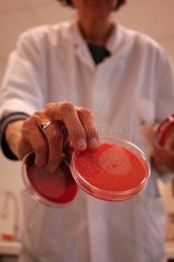 Petri Box in einem Labor der Bakteriologie Frankreich