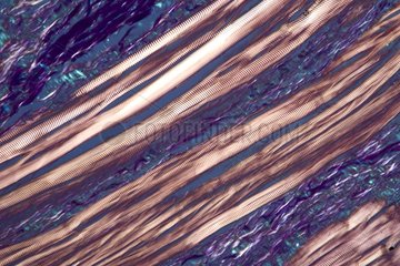 Transversal cut of a tongue striated muscle