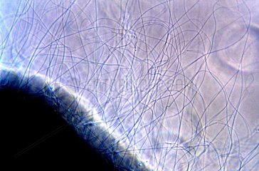 Ejected filaments of Mauve stinger jellyfish Estartit