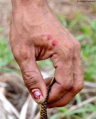 Snake Bite  Peters' Cobra (Naja samarensis) (Naja samarensis)  Games in Bohol  Philippines