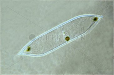 Rhizosolenia diatom in optical microscopy