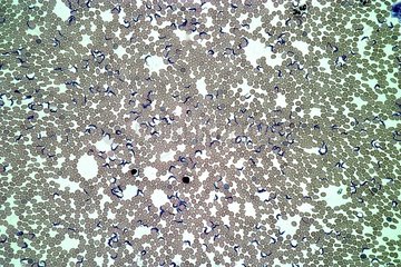Dromedary trypanosome Zoom x200