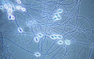 Ejected filaments of Mauve stinger jellyfish Estartit