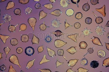 Fossils of Radiolaria of Barbados Island under microscope