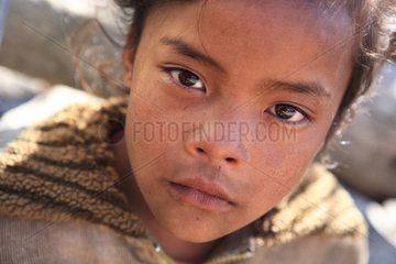 Portrait of girl marked by cold Annapurna Nepal