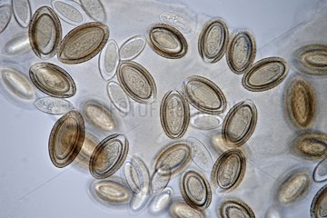Eggs of thorny headed worm parasite under microscope