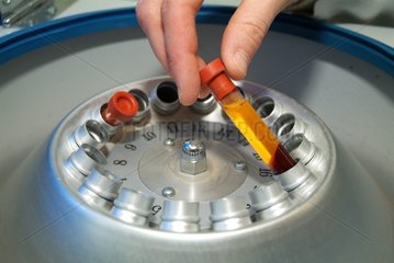 Tube blood placed in a centrifugal machine for analyses