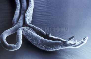 Couple de Schistosome en microcopie électronique à balayage