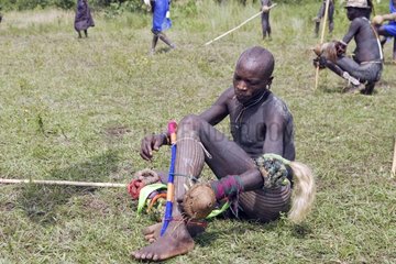 Surma warrior wounded during a stick fighting Ethiopia