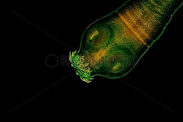 Tapeworm scolex of pork on black background