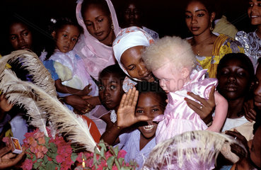 Sudan. Albino girl during a ceremony.