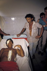 Contemporary slavery in Amazon rainforest  Brazil. Victim of torture who got to escape from the Estate where he was kept imprisoned receives medical treatment in local hospital. Slave work in the forest clearance job. Human rights violation.