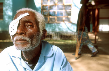 A grey haired man sits in the Hospital garden with a patch over his eye. He has had an eye surgery helping him to regain his eyesight. The doctor and his team helps near 800 patients pr. Annum. The project is finaced by NABP  Norwegian Chimoio provincial