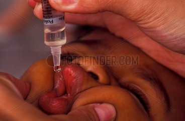 Black child takes vaccine against poliomyelitis or infantile paralysis  a serious infectious disease of the nerves in ths spine  often resulting in a lasting paralysis  Rio de Janeiro  Brazil.