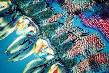 Transversal cut of a cat tongue in polarized light