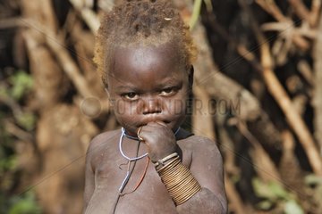 Portrait of a Surma child suffering from kwashiorkor