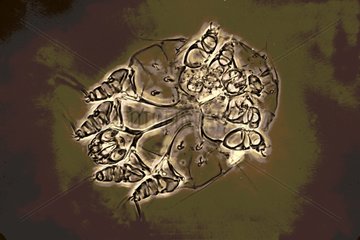 Female Scabies mite under microscope