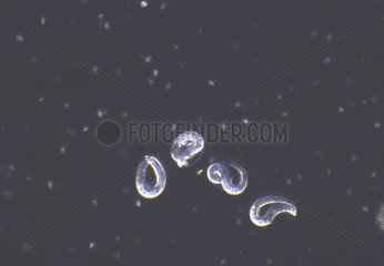 Ovocites of the Nematode parasite of European Eels