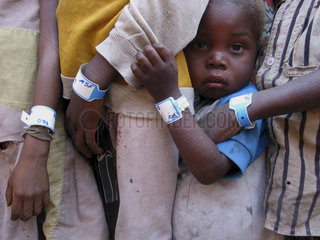 Closeup of young Angolan children waiting in line at an MSF feeding clinic. Each wears an identification bracelet. Feeding centres and other humanitarian aid were organised in Angola after widescale malnutrition during and following the countrys civil wa