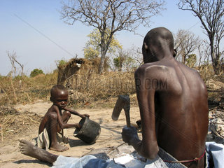 A man and boy suffering from malnutrition in Angola. Feeding centres and other humanitarian aid were organised in Angola after widescale malnutrition during and following the countrys civil war.