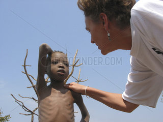 An MSF staff member examines a malnourished child. Feeding centres and other humanitarian aid were organised in Angola after widescale malnutrition during and following the countrys civil war.
