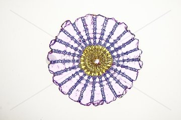 Transversal cut of a spine of sea urchin